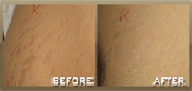 Animated sequence of cosmetic procedure steps