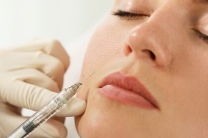 Restylane fillers