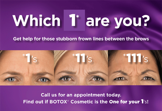 botox---which-1