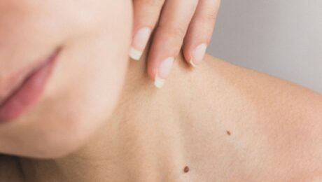 Chronic Skin
