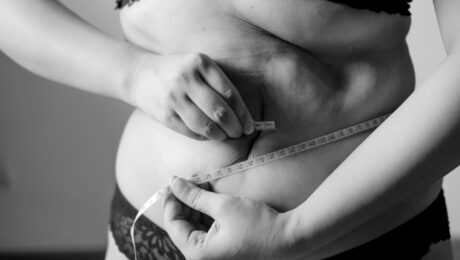 CoolSculpting