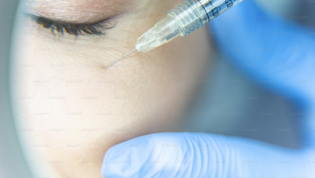 Botox and Fillers