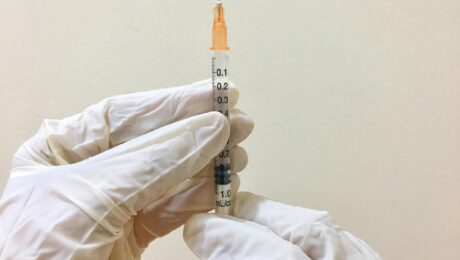 Varicose Vein