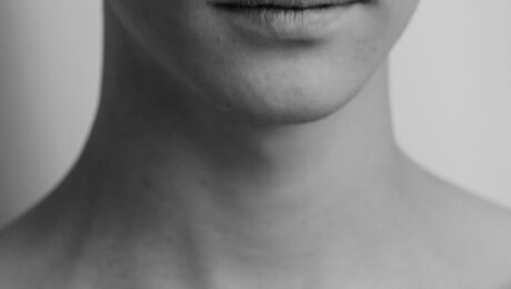 Acne and Rosacea