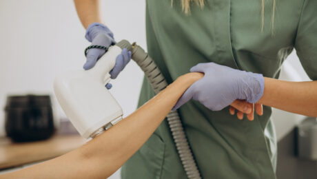 Laser hair removal