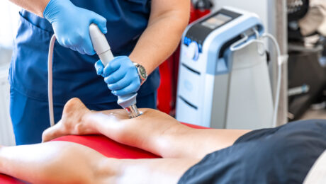 Laser vs. Sclerotherapy