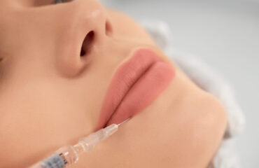 Restylane