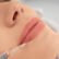 Restylane