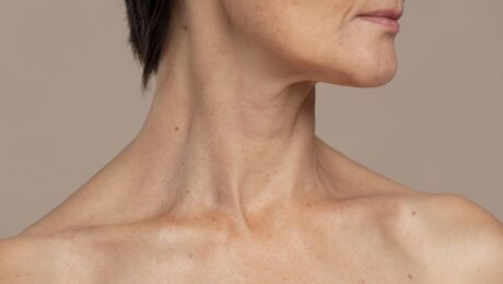CoolSculpting and Kybella