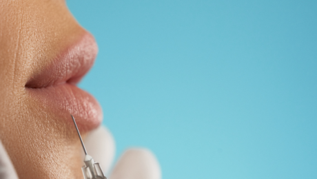 Restylane