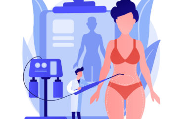 CoolSculpting