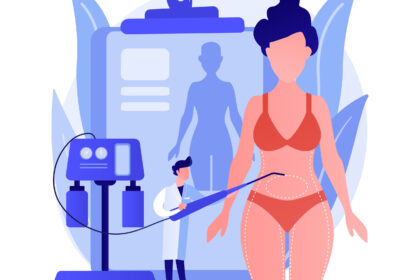CoolSculpting