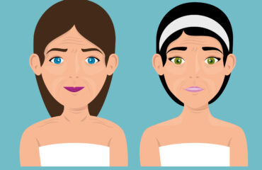 Botox