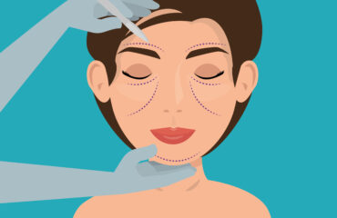 dermal fillers