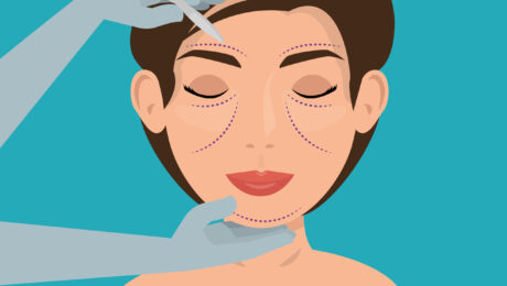 dermal fillers