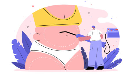 CoolSculpting