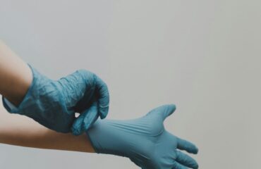 Varicose Veins