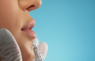 Restylane