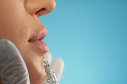 Kybella