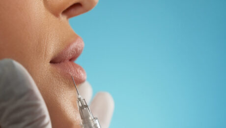 Kybella