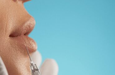 Restylane