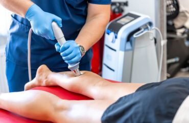 Laser vs. Sclerotherapy