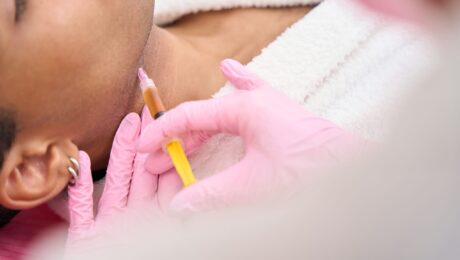 Kybella