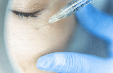 Botox and Fillers