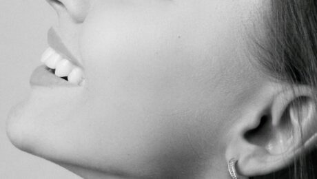 Restylane