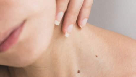 Chronic Skin