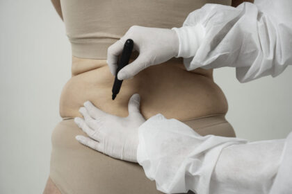 Injectable Fat Dissolving Treatments in LA