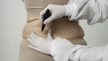 Injectable Fat Dissolving Treatments in LA