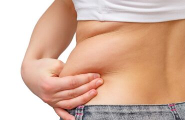 CoolSculpting or Liposuction