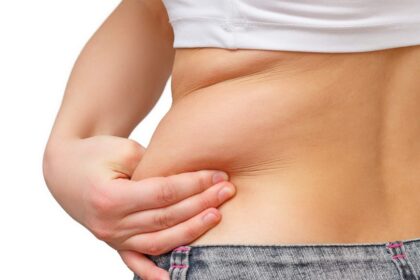 CoolSculpting or Liposuction