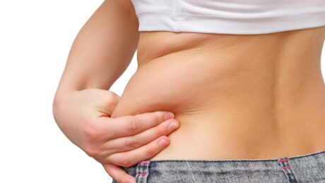 CoolSculpting or Liposuction