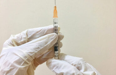 Varicose Vein