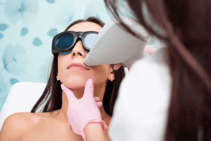 laser hair removal