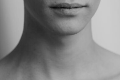 leonid-shaydulin-nSP00KhzbvE-unsplash-scaled Acne and Rosacea