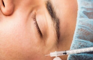 Botox with Fillers