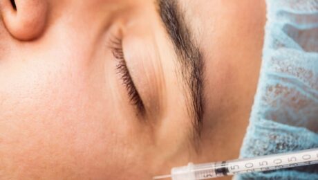 Botox with Fillers