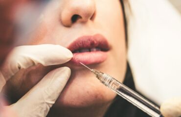 Fillers