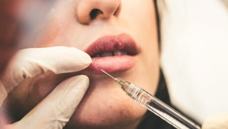 Fillers