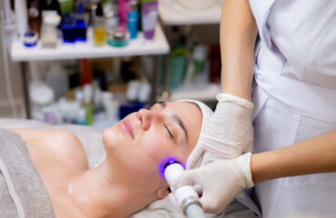 IPL photofacial IPL photofacial